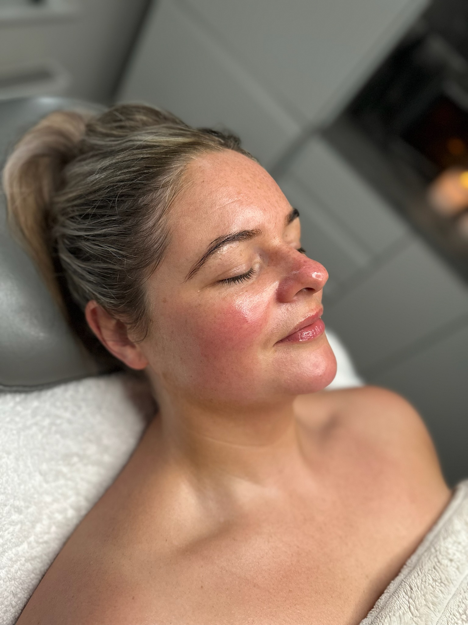Healthy skin support at ClearSkin4u Stockport