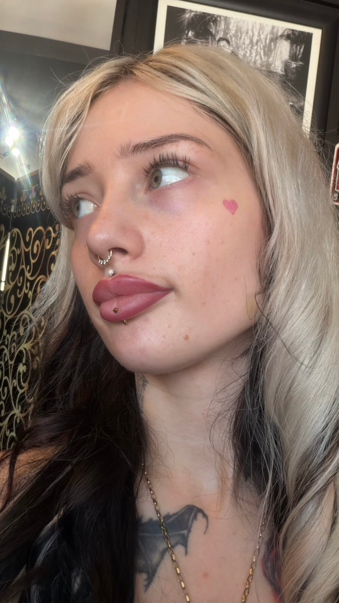 Client progress following a personalised hormonal acne plan